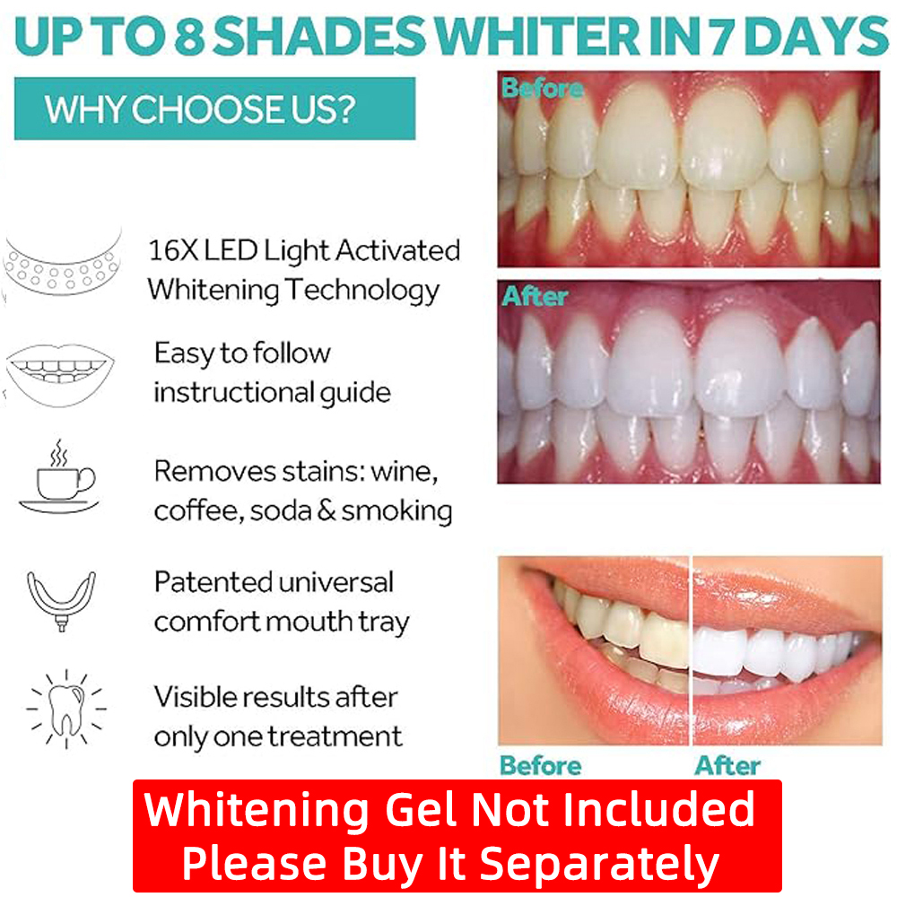 Vaclav Teeth Whitening Light K - Teeth Whitening Uv Light 리뷰 및 가격