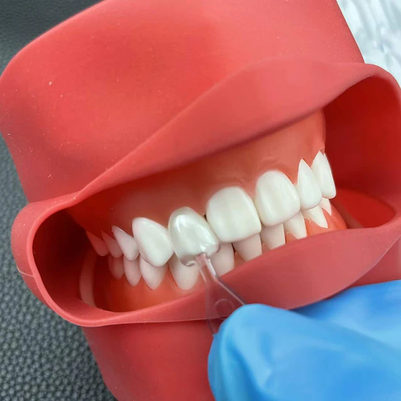1Set/3Set/5Set Dental Veneer M - Teeth Whitening Moulds 리뷰 및 가격
