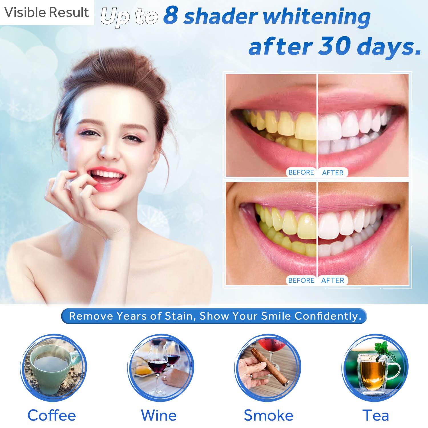 Teeth Whitening Gel Refill Syr - Teeth Whitening Clinic 리뷰 및 가격