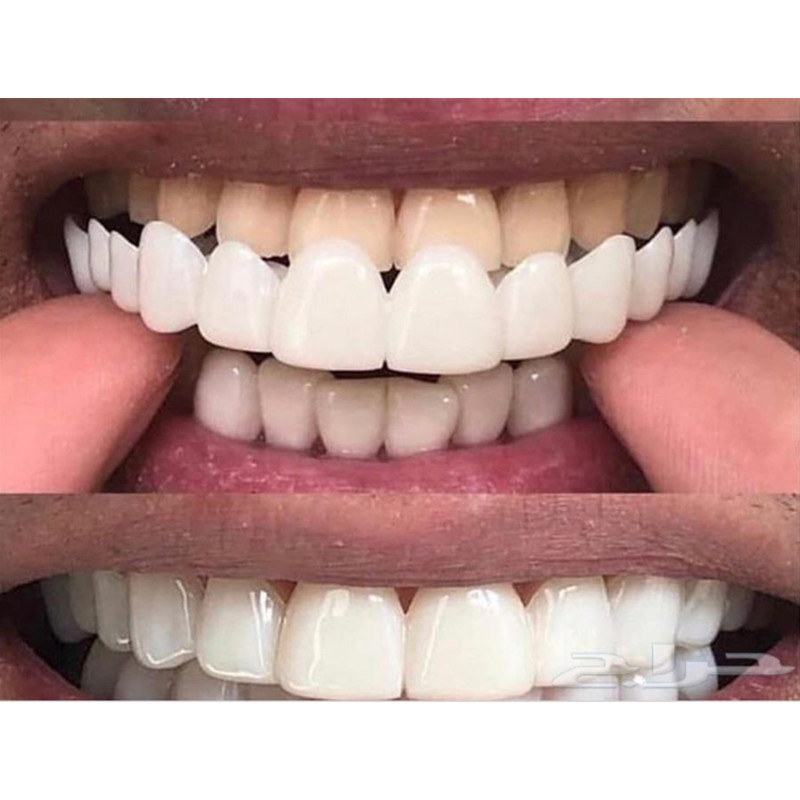 Soft Silicone Gel Dental Oral  - Teeth Whitening Moulds 리뷰 및 가격