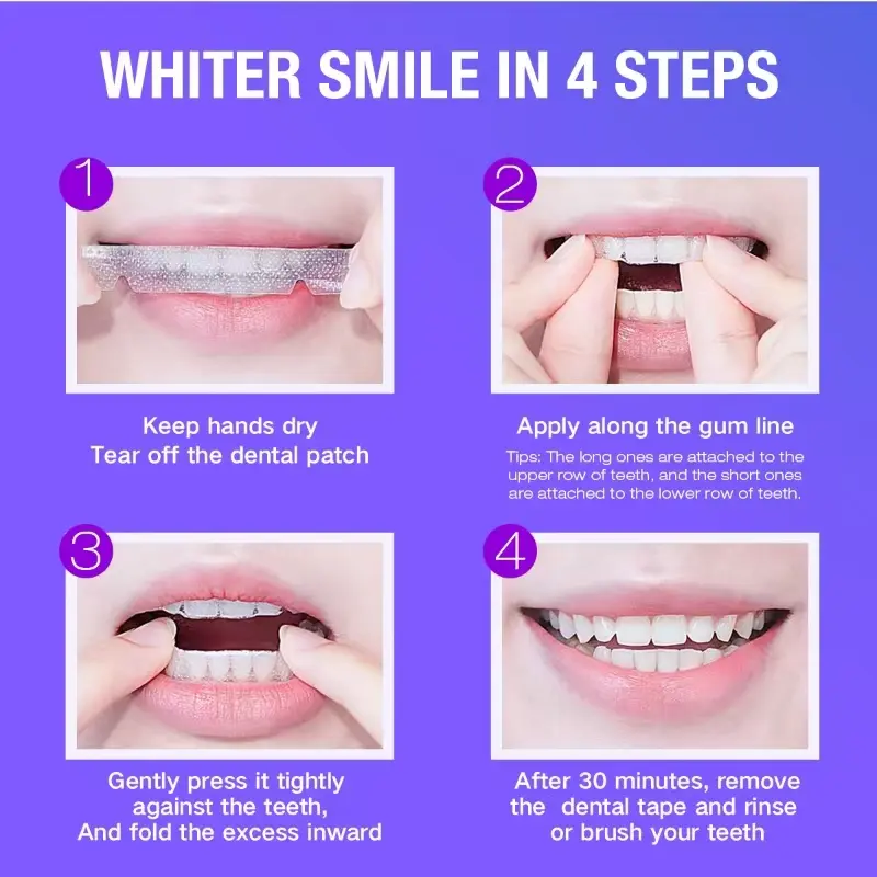 Teeth Whitening Kit - 5X LED L - Teeth Whitening Clinic 리뷰 및 가격