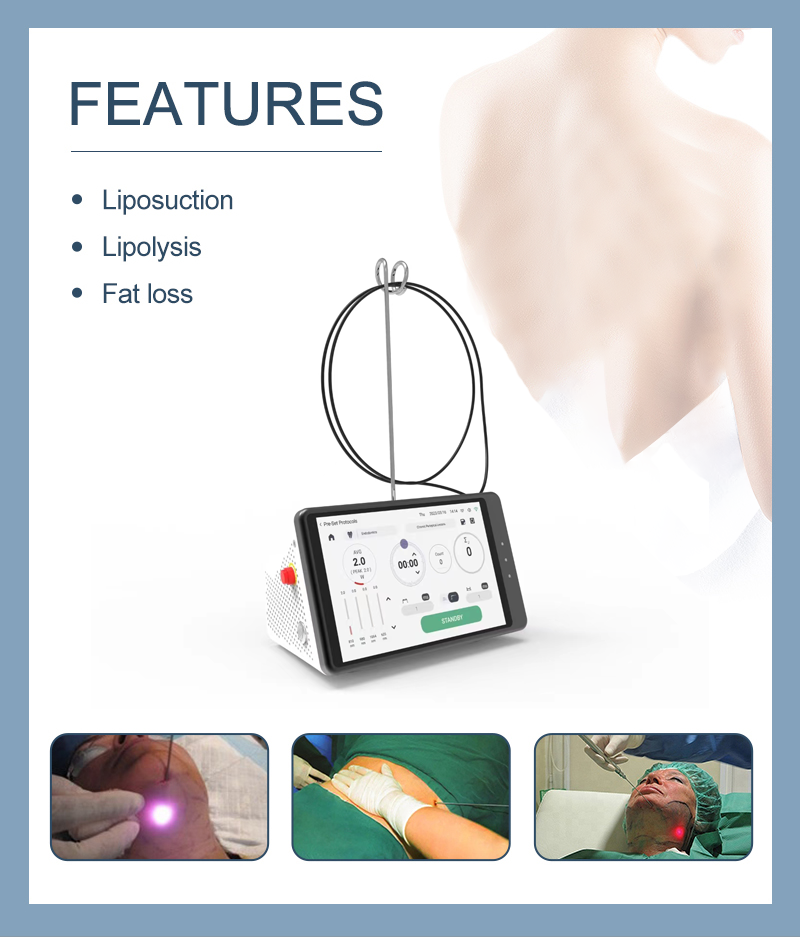 Dental Laser Teeth Whitening D - Teeth Whitening Clinic 리뷰 및 가격
