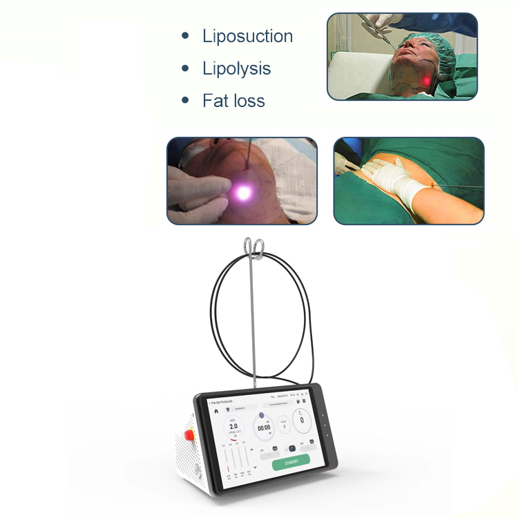 Dental Laser Teeth Whitening D - Teeth Whitening Clinic 리뷰 및 가격