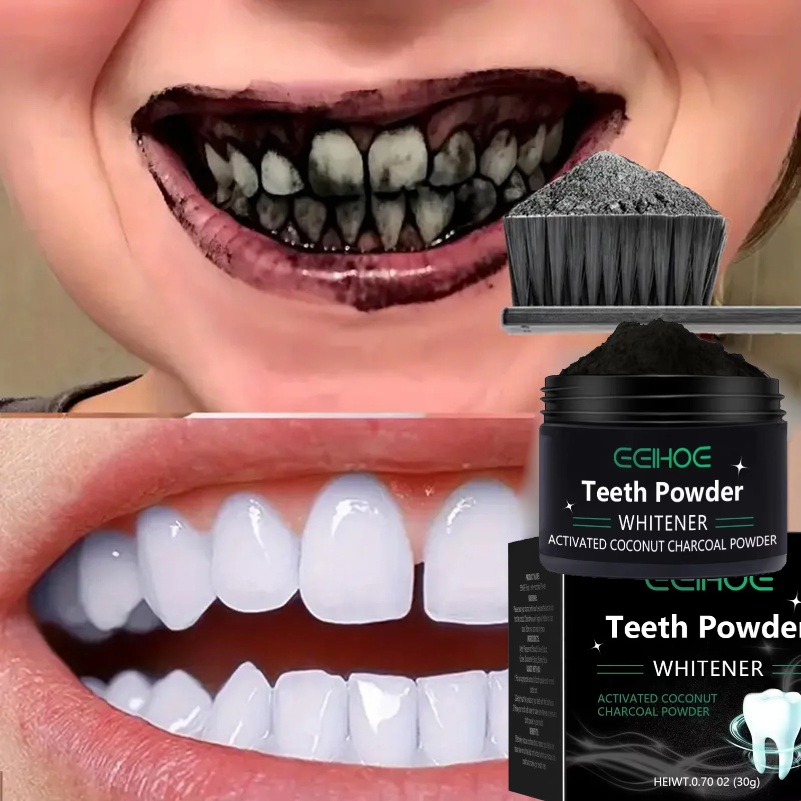Teeth Brightening Whitening Po - Teeth Whitening Clinic 리뷰 및 가격