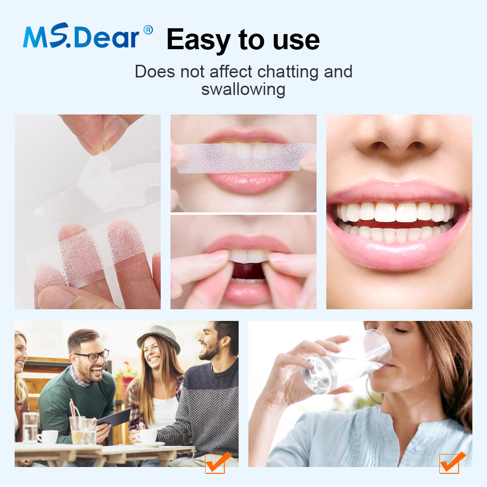 Teeth Whitening Strips Cleansi - Teeth Whitening Clinic 리뷰 및 가격